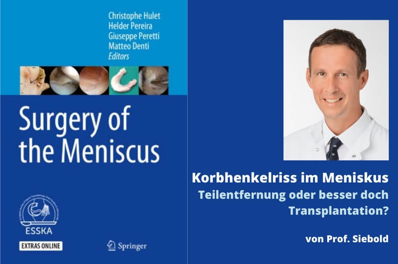 Prof. Siebold ATOS Meniskus